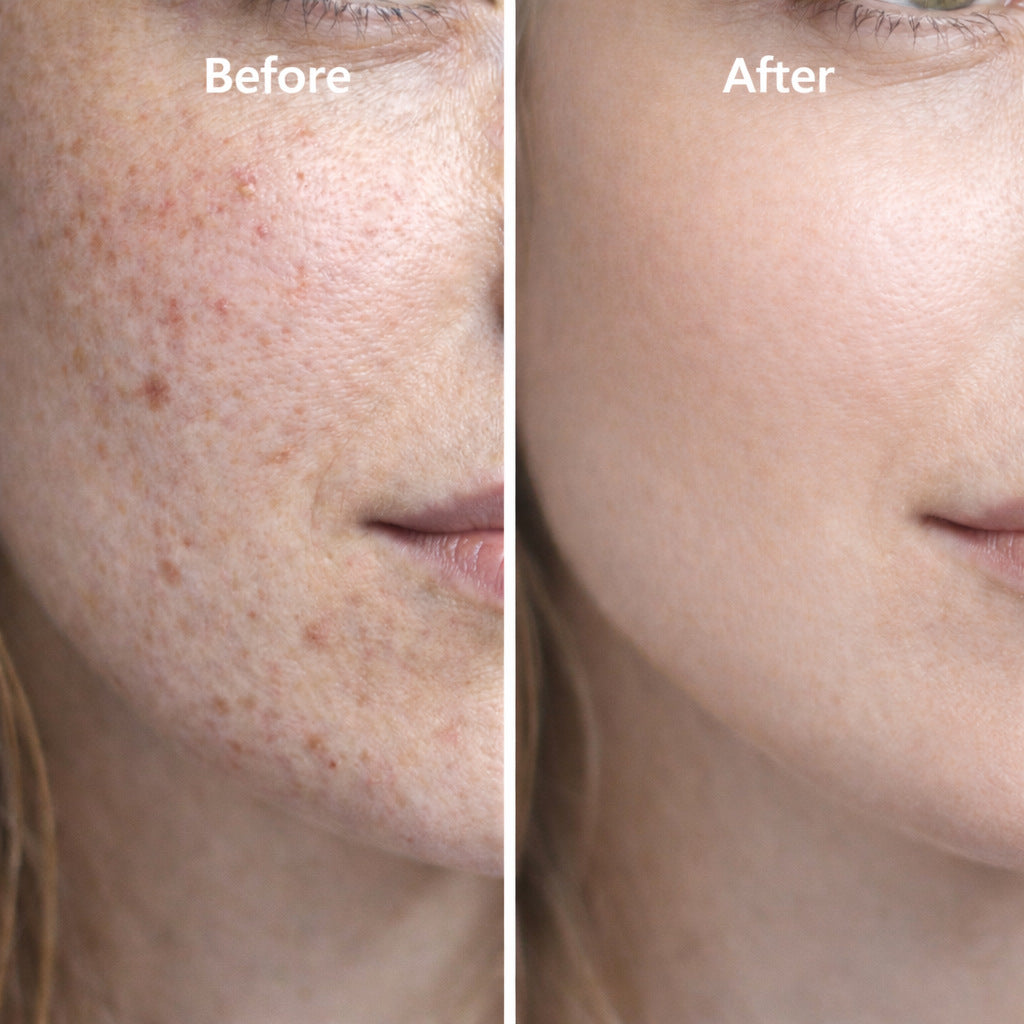 Boost & Skin Repair