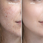 Boost & Skin Repair