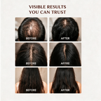 Visible hair growth results after using pure batana oil, thicker fuller hair